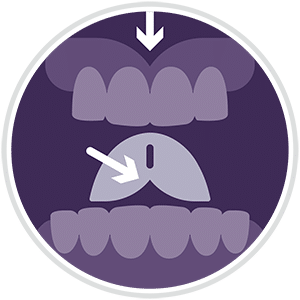 Sleep apnea services